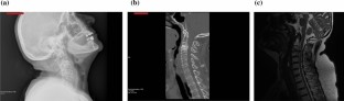 kf case study conclusion