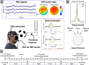 サッカーのヘディングが脳の活動を一時的に鈍らせるとの研究結果(Soccer headers briefly slow brain activity, study shows)