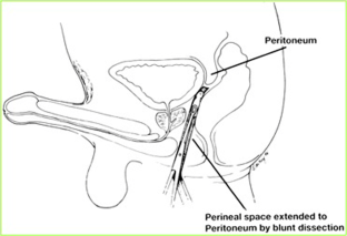 scholarly articles on gender reassignment surgery