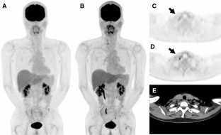 Evaluating and comparing the image quality and quantification accuracy ...