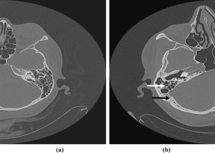 extended data figure 1