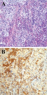 MTAP immunohistochemistry is an accurate and reproducible ...