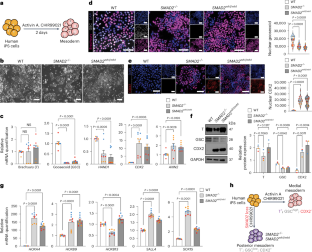 先天性心疾患の変異が腎障害に関連(Congenital heart disease mutation linked to kidney damage)