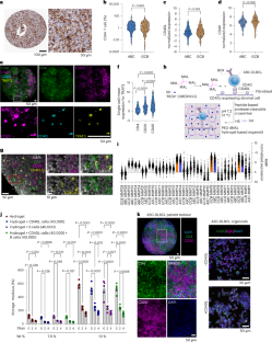 画期的なリンパ腫腫瘍モデルで新しい治療法への道を開く(Groundbreaking Lymphoma Tumor Model Paves Way for New Therapies)