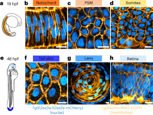 細胞核が目と脳をどのように組織しているか(How cell nuclei organize eyes and brain)