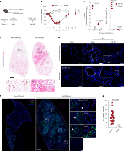 ウイルスが肺の免疫細胞に潜伏していることが発見された(Viruses found hiding in lungs’ immune cells long after initial illness)