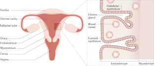 endometrial cancer thesis