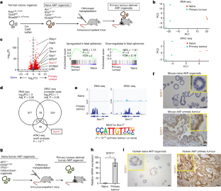 早期がん細胞はどのように免疫システムから隠れるのか(How early-stage cancer cells hide from the immune system)