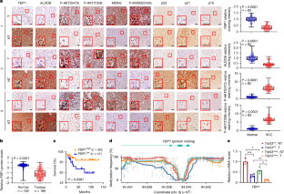 肝臓がんの「時限爆弾」(A “Ticking Time Bomb” for Liver Cancer)