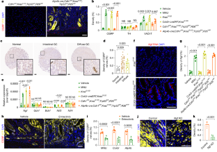 神経が胃がんの成長を促進するメカニズム(Nerves Electrify Stomach Cancer, Sparking Growth and Spread)