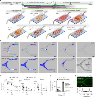 血栓を模倣する3Dマイクロチップの開発(3D Microchip Mimics Blood Clots, Potentially Enhancing Treatment Options)