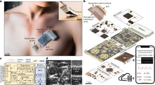 動き回る被験者のためのワイヤレス超音波モニタリングの飛躍的な進歩(A Giant Leap Forward in Wireless Ultrasound Monitoring for Subjects in Motion)