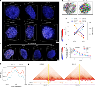 グリオブラストーマ(膠芽腫:GBM)におけるHDAC1凝縮体の破壊が薬剤耐性克服を助ける(Disrupting HDAC1 Condensates in Glioblastoma Help to Overcome Drug Resistance)