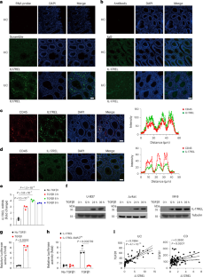 炎症性腸疾患を防ぐ新しい「デコイ受容体」を発見 (Researchers Reveal a Novel Natural “Decoy Receptor” That Protects Against Inflammatory Bowel Disease)