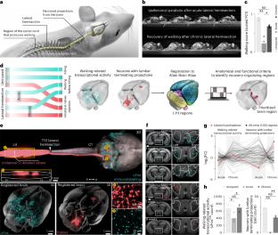 視床下部を刺激すると麻痺患者の歩行が回復する(Stimulating hypothalamus restores walking in paralyzed patients)
