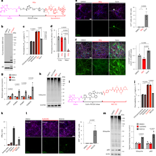 アルツハイマー病発症初期の手掛かりを発見（New Study Finds Clues to Alzheimer’s Beginnings）