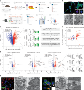 老化する脳:タンパク質マッピングが新たな知見をもたらす(The aging brain: protein mapping furnishes new insights)