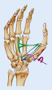 anatomie-des-daumensattelgelenks-unter-ber-cksichtigung-der