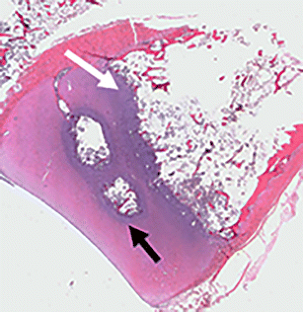 Development of the long bones in the hands and feet of children