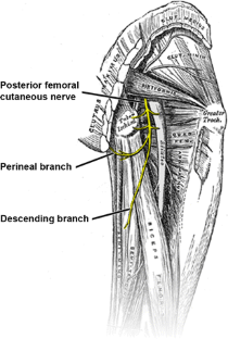 High-resolution magnetic resonance-guided posterior femoral cutaneous