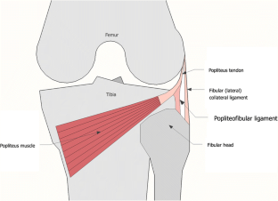 The popliteal fibular ligament in acute knee trauma: patterns of injury ...