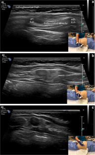 Dynamic ultrasound in the evaluation of patients with suspected ...