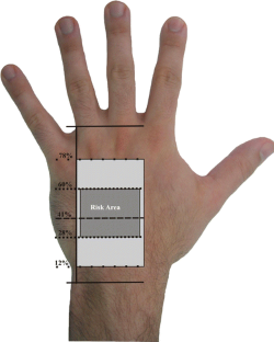 The clinical anatomy of the communications between the radial and ulnar