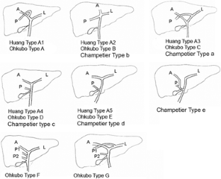 Bile duct anatomy of the Anatolian Caucasian population: Huang ...