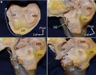 An anatomic study on the attachment of the joint capsule to the tibia