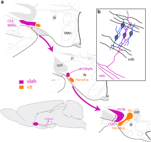 Parasubthalamic and calbindin nuclei in the posterior lateral