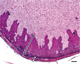 Bovine papilloma: aetiology, pathology, immunology, disease status ...