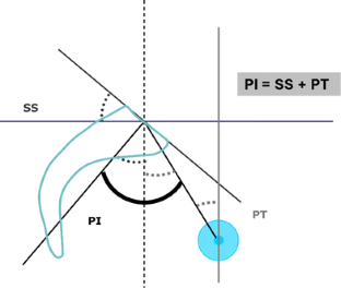 Sagittal balance of the pelvis-spine complex and lumbar degenerative