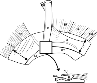 The clinical anatomy of the insertion of the rotator cuff tendons
