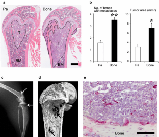 bone metastasis cancer mouse breast model fig c57bl establishment characterization