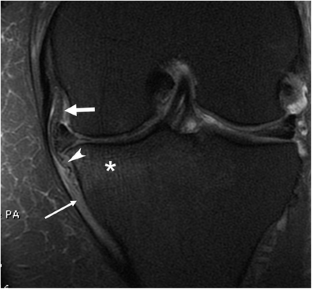 Structure and function, injury, pathology, and treatment of the medial ...