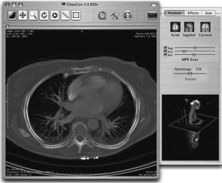 osirix dicom image library osirix dicom image library