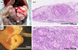 Establishment Of A Den Induced Mouse Model Of Esophageal Squamous Cell Carcinoma Metastasis