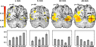 PyMVPA: a Python Toolbox for Multivariate Pattern Analysis of fMRI Data ...
