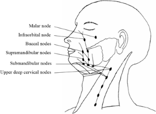 Facial lymph node involvement as a prognostic factor for patient ...