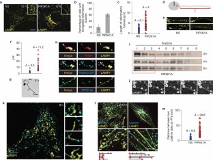 Clathrin and phosphatidylinositol-4,5-bisphosphate regulate autophagic