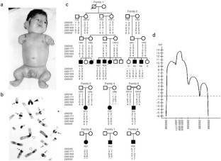 Roberts syndrome is caused by mutations in ESCO2 , a human homolog of ...