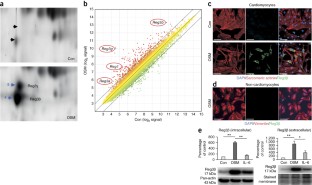 Myocardial healing requires Reg3β-dependent accumulation of macrophages ...