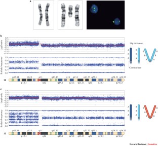 A genomic view of mosaicism and human disease | Nature ...