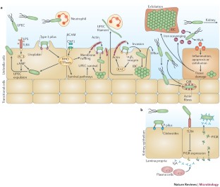 urinary tract epidemiology