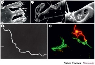 Lyme Neuroborreliosis—epidemiology, Diagnosis And Management | Nature ...