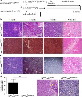 p53 mutations cooperate with oncogenic Kras to promote adenocarcinoma ...