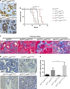 p53 mutations cooperate with oncogenic Kras to promote adenocarcinoma ...