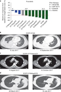 Mechanisms and clinical activity of an EGFR and HER2 exon 20–selective