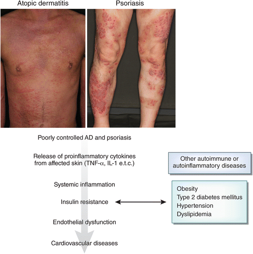 bpc-157 psoriasis evidence Inflammatory skin march” in atopic dermatitis and psoriasis | Inflammation  Research