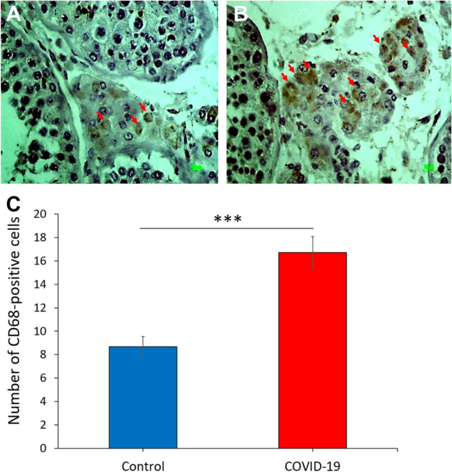 Morphology of Leydig cells in the testes after in vivo MCP-1 treatment.